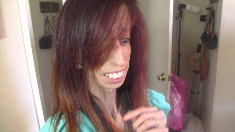 Lizzie Velasquez 5