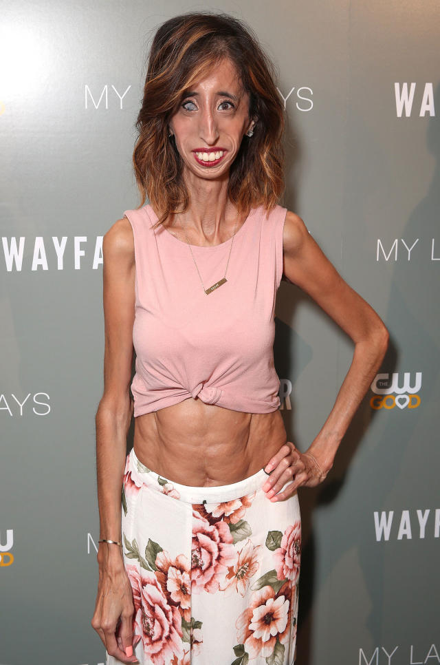 Lizzie Velasquez 7