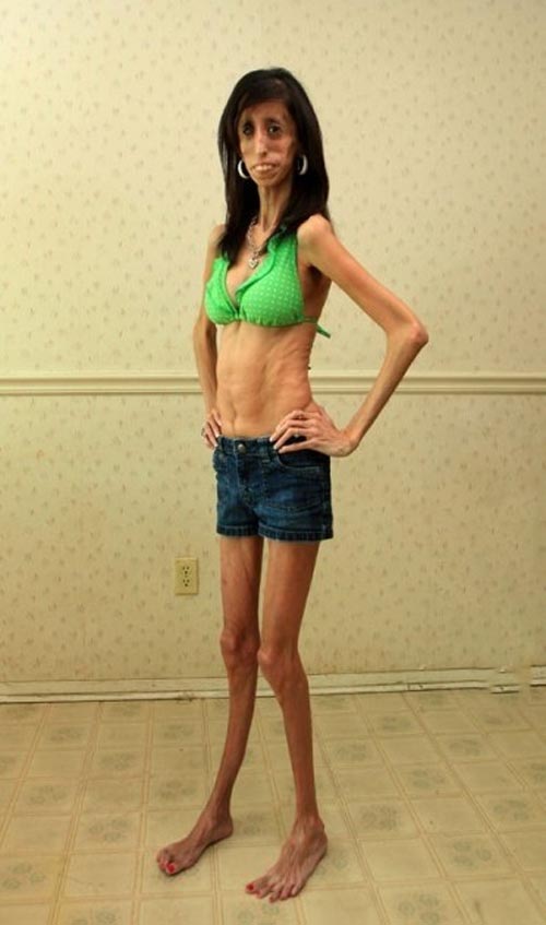 Lizzie Velasquez 8