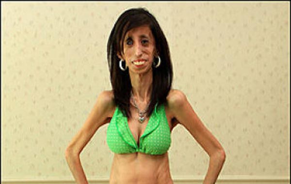 Lizzie Velasquez 9