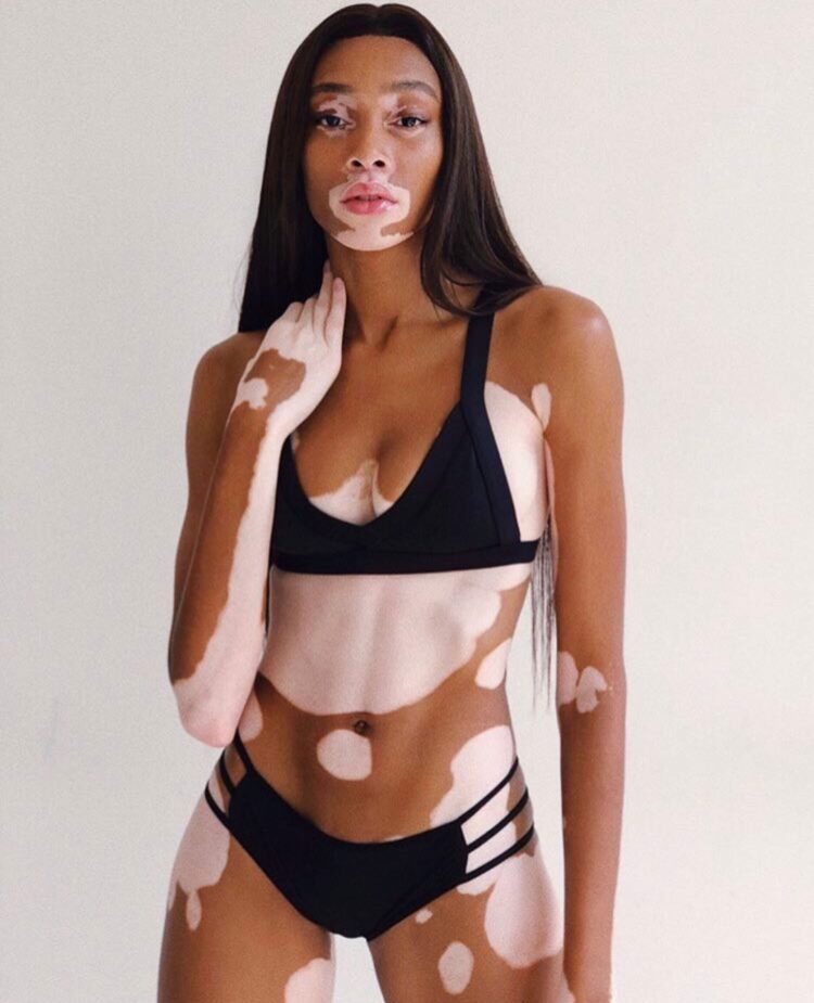 Winnie Harlow 6 scaled