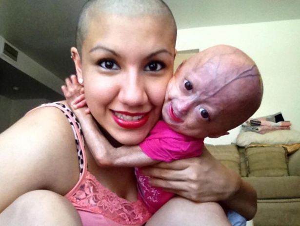 adalia rose 1