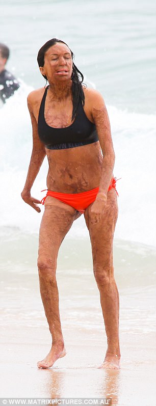 turia pitt 2