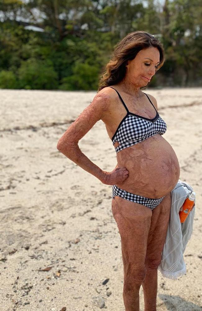 turia pitt 4