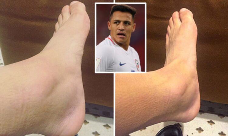 alexis sanchez feet 2