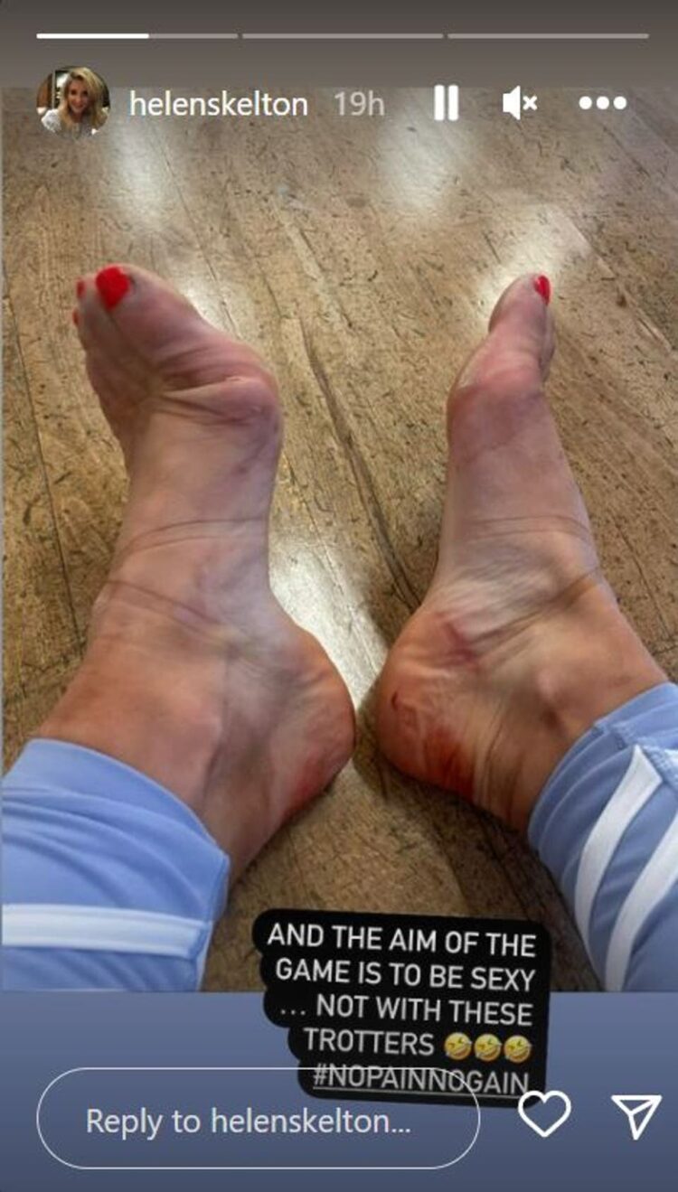 amy skelton feet