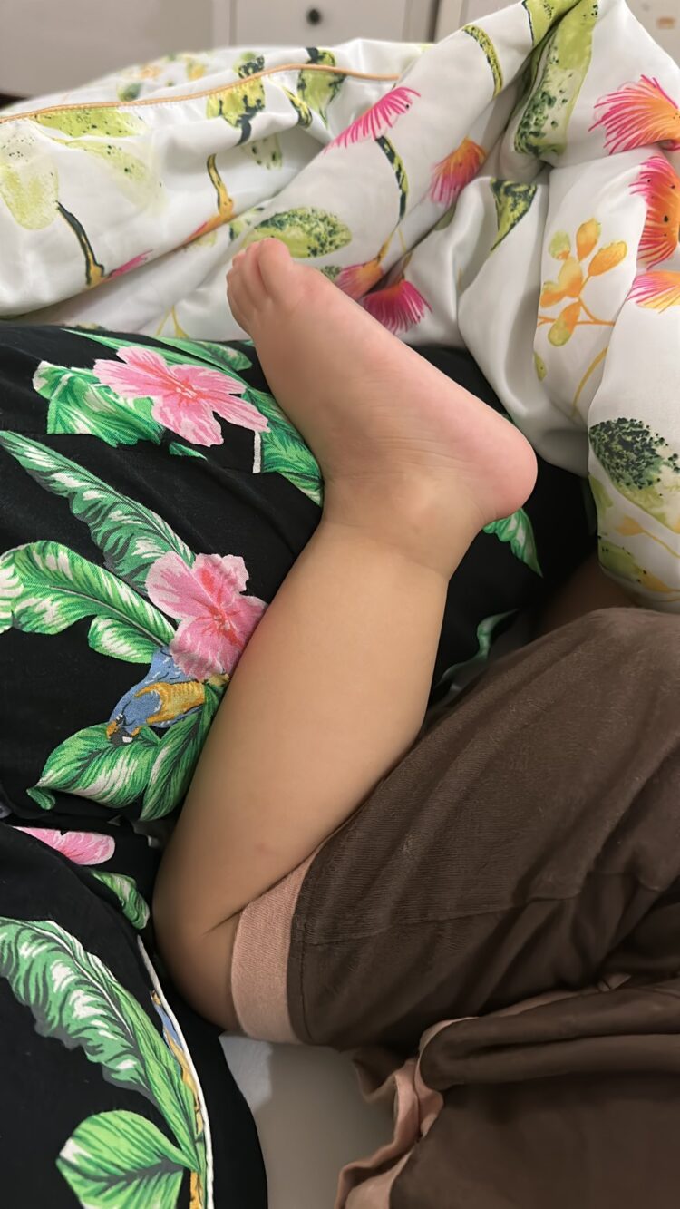 anesstesia ayu andari feet