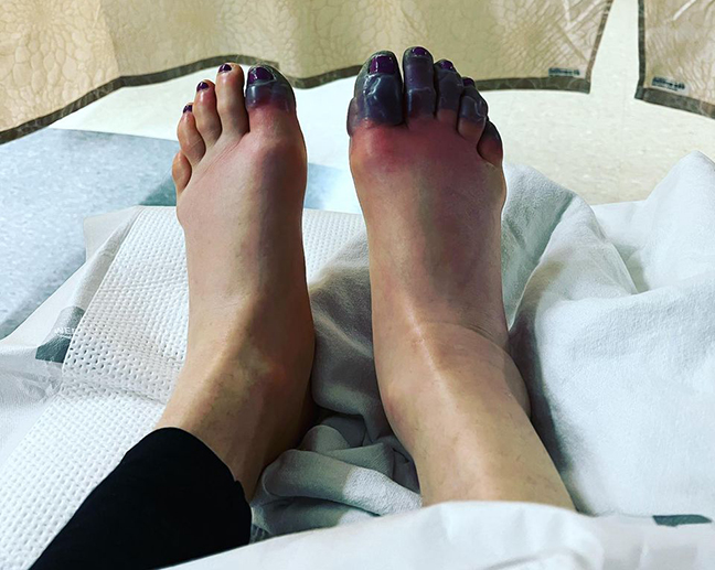 ann colin feet 2