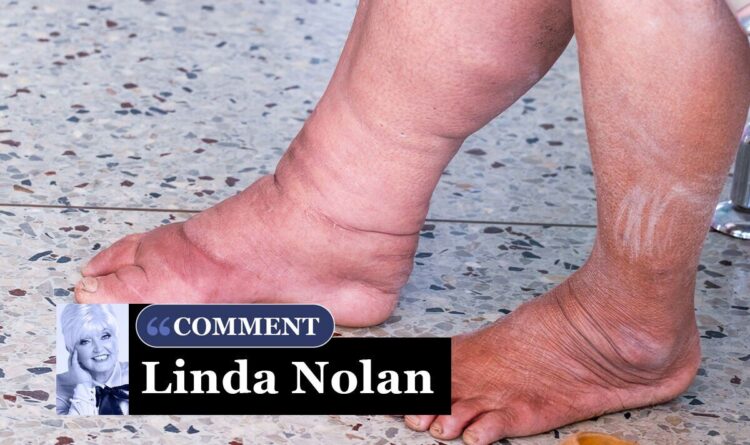 annie nolan feet