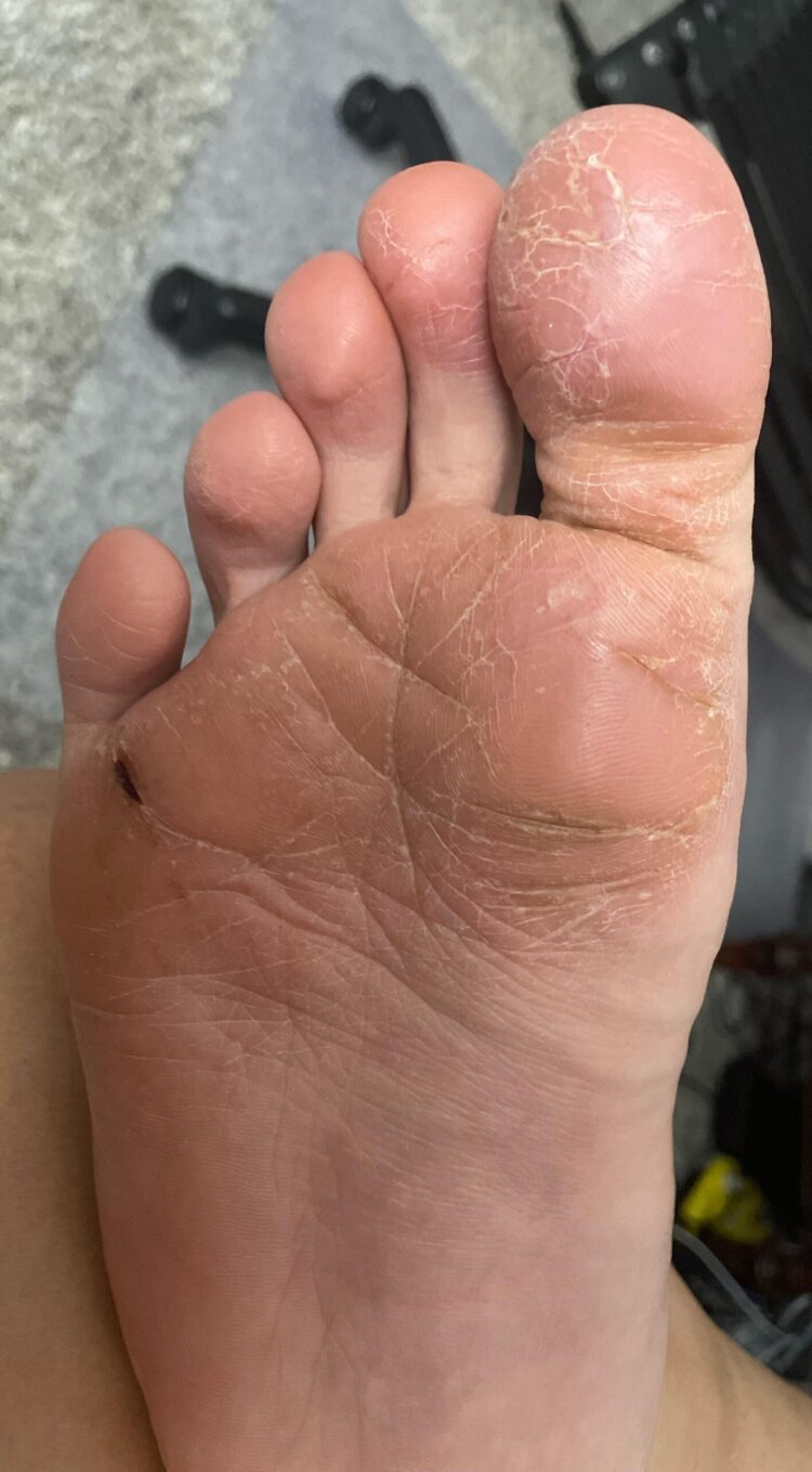 vinegar strokes feet 2 scaled