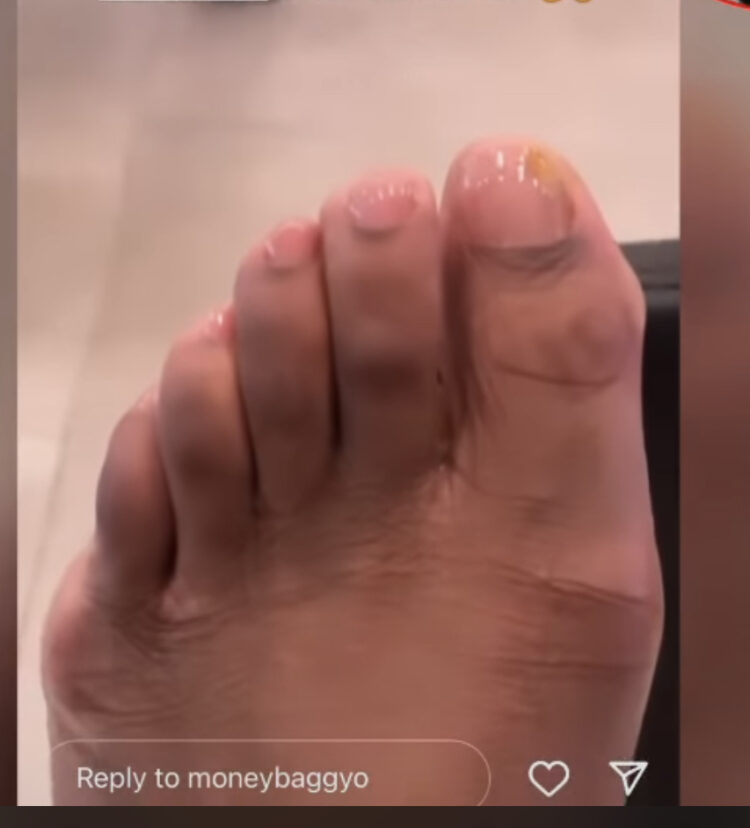 yo yo feet 5